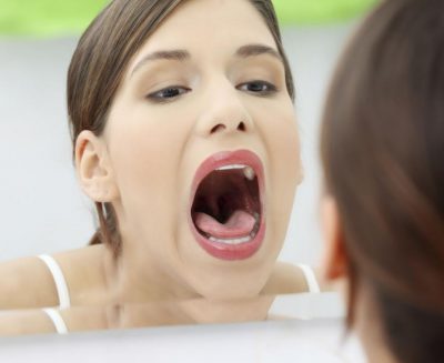 Как вылечить волдырь во рту