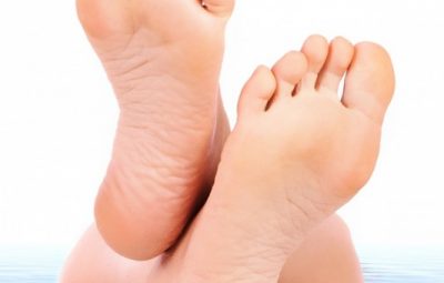 Шишки от мозолей на пальцах ног причины и лечение
