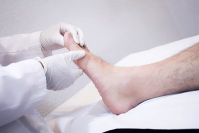 Виды мозолей на большом пальце ноги лечение